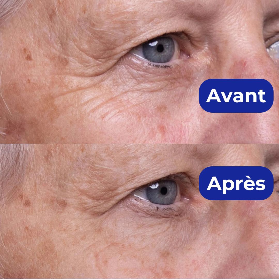 3 paires de 2 Patchs Anti-Rides - Poches sous les Yeux