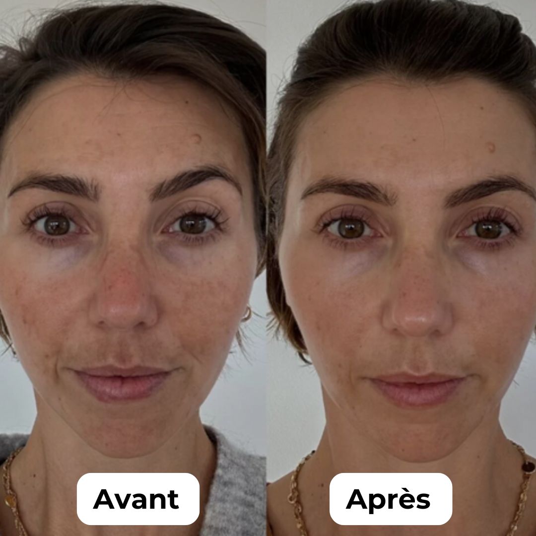 Stylo de Microneedling Pro 7 - Kit complet